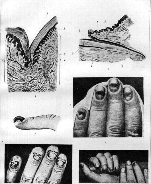 Nail: figure 1 from the 1928–1936 encyclopedia article