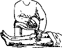 Clonus: figure 2 from the 1928–1936 encyclopedia article