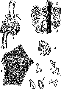Nitrogen-Fixing Bacteria: figure 2 from the 1928–1936 encyclopedia article