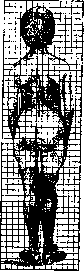 Scoliosometer: figure 3 from the 1928–1936 encyclopedia article