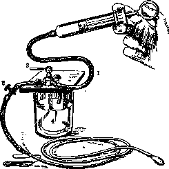 Duodenal Tube (Aluminium subaceticum is added to the washing): figure 1 from the 1928–1936 encyclopedia article