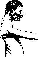 Scapula Alata: figure 1 from the 1928–1936 encyclopedia article