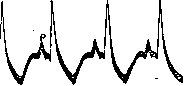 Electrocardiography: figure 11 from the 1928–1936 encyclopedia article