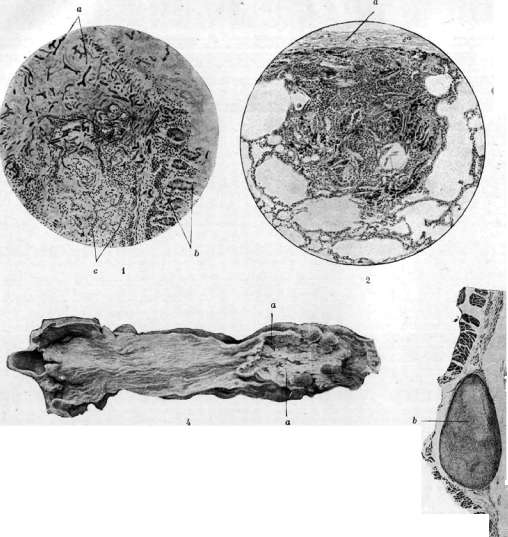 Esophagus: figure 14 from the 1928–1936 encyclopedia article