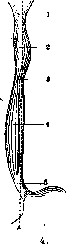 Esophagus: figure 3 from the 1928–1936 encyclopedia article