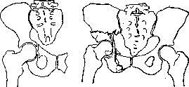 Pelvis: figure 9 from the 1928–1936 encyclopedia article