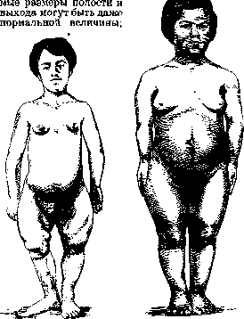 Pelvis: figure 20 from the 1928–1936 encyclopedia article
