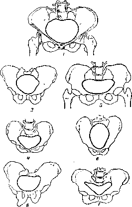 Pelvis: figure 18 from the 1928–1936 encyclopedia article
