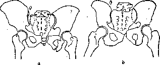 Pelvis: figure 12 from the 1928–1936 encyclopedia article