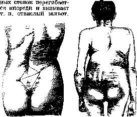 Pelvis: figure 26 from the 1928–1936 encyclopedia article