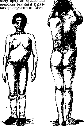 Pelvis: figure 19 from the 1928–1936 encyclopedia article