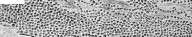 Dermatophytes: figure 6 from the 1928–1936 encyclopedia article
