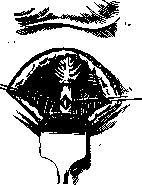 Prostate Gland: figure 17 from the 1928–1936 encyclopedia article