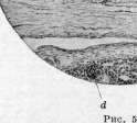 Inguinal Region: figure 7 from the 1928–1936 encyclopedia article