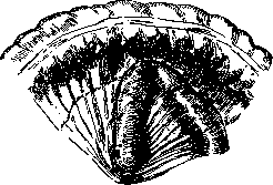 Gastroenterostomy: figure 6 from the 1928–1936 encyclopedia article
