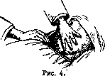 Palpation: figure 2 from the 1928–1936 encyclopedia article