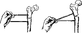 Hip Joint: figure 28 from the 1928–1936 encyclopedia article