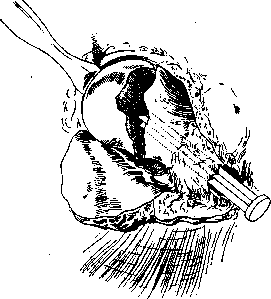 Hip Joint: figure 19 from the 1928–1936 encyclopedia article