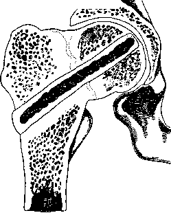 Hip Joint: figure 32 from the 1928–1936 encyclopedia article