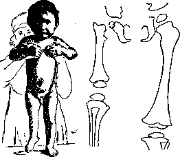 Hip Joint: figure 1 from the 1928–1936 encyclopedia article