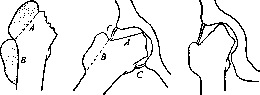 Hip Joint: figure 31 from the 1928–1936 encyclopedia article