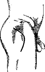 Hip Joint: figure 37 from the 1928–1936 encyclopedia article