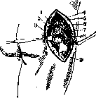 Hip Joint: figure 38 from the 1928–1936 encyclopedia article