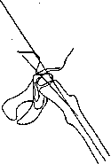 Hip Joint: figure 5 from the 1928–1936 encyclopedia article