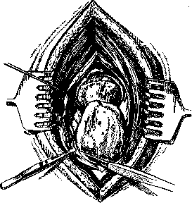 Hip Joint: figure 35 from the 1928–1936 encyclopedia article