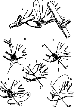 Common Carotid Artery: figure 5 from the 1928–1936 encyclopedia article