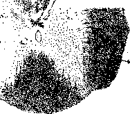 Fasciculi: figure 1 from the 1928–1936 encyclopedia article