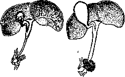 Jaundice: figure 2 from the 1928–1936 encyclopedia article