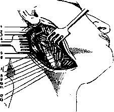 Facial Nerve (facial nerve, the seventh pair of cranial): figure 4 from the 1928–1936 encyclopedia article