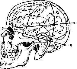 Cerebro-Cranial Topography: figure 8 from the 1928–1936 encyclopedia article