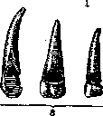 Caries: figure 3 from the 1928–1936 encyclopedia article