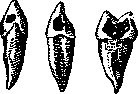 Caries: figure 5 from the 1928–1936 encyclopedia article