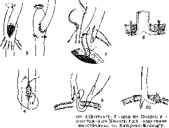 Ureter: figure 14 from the 1928–1936 encyclopedia article