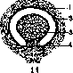 Panaritium: figure 10 from the 1928–1936 encyclopedia article