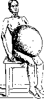 Ovariotomy: figure 6 from the 1928–1936 encyclopedia article