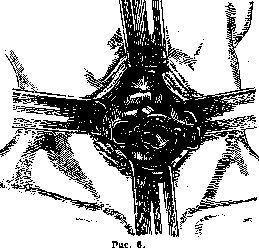Tracheotomy: figure 6 from the 1928–1936 encyclopedia article