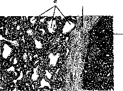 Angioma: figure 2 from the 1928–1936 encyclopedia article