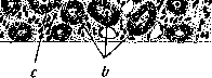 Angioma: figure 1 from the 1928–1936 encyclopedia article