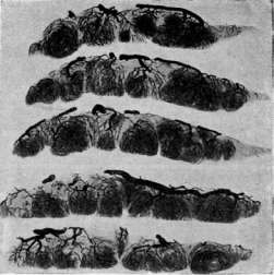 Placenta: figure 6 from the 1928–1936 encyclopedia article
