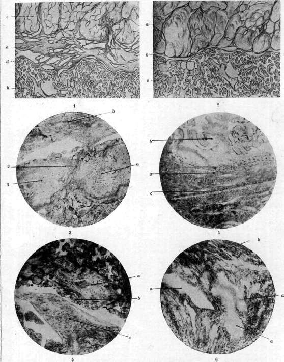 Placenta: figure 8 from the 1928–1936 encyclopedia article