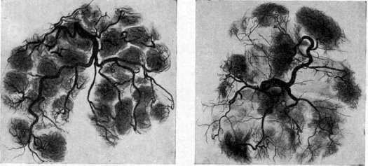 Placenta: figure 7 from the 1928–1936 encyclopedia article