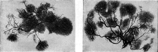 Placenta: figure 4 from the 1928–1936 encyclopedia article