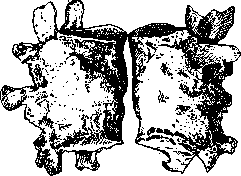 Arthritis: figure 1 from the 1928–1936 encyclopedia article