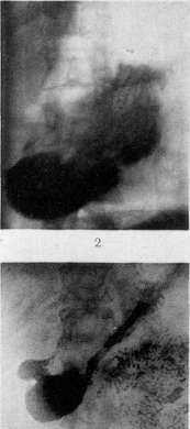 Stomach: figure 26 from the 1928–1936 encyclopedia article