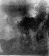 Stomach: figure 27 from the 1928–1936 encyclopedia article