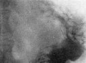 Stomach: figure 25 from the 1928–1936 encyclopedia article